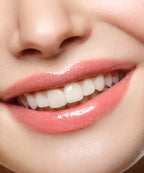 Infracyte Luscious Lips Anti-Aging Lip 326 Main Attraction