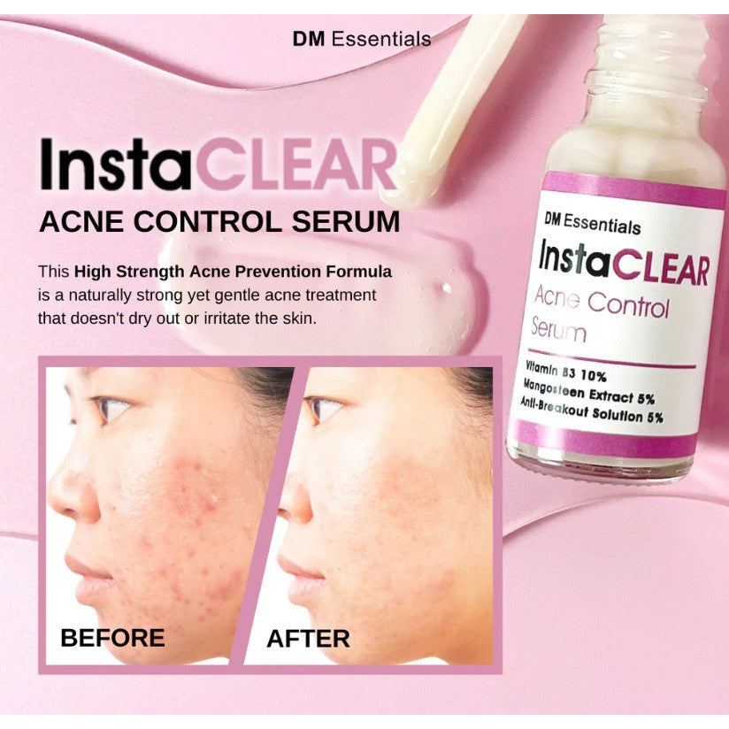 DM Essentials InstaCLEAR Acne Control Serum 20ML