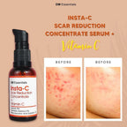 DM Essentials Scar Reduction Concentrate + Vitamin C 30ML