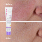 Topicrem Calm+ AR Anti-Redness Daily Cream 40ML