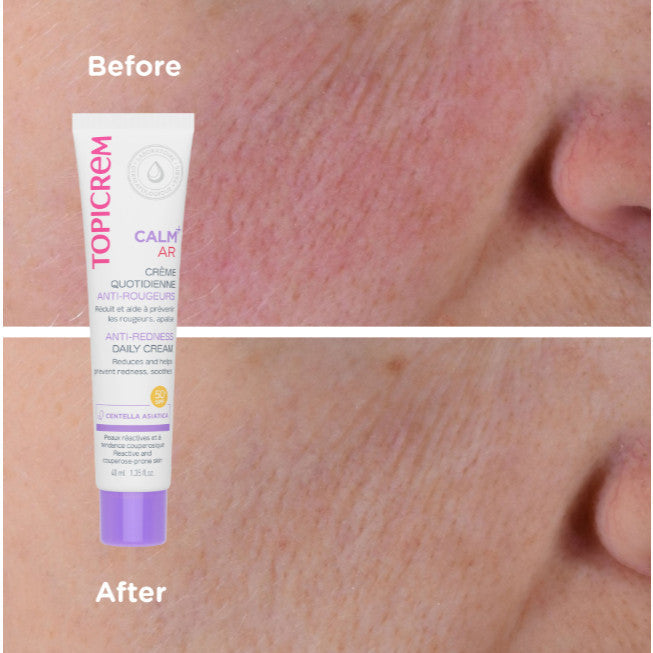 Topicrem Calm+ AR Anti-Redness Daily Cream 40ML
