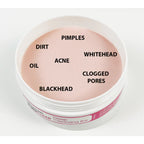 DM Essentials InstaCLEAR Deep Cleansing Bar 75G Sabun Acne Pimple Jerawat Blemish Blackhead Whitehead Remover Soap