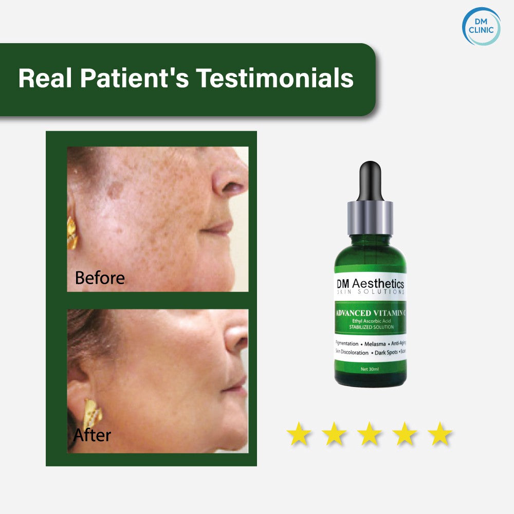 DM Aesthetics Advanced Vitamin C (25%) 30ML